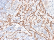 Beta-Catenin Antibody Tonsil IHC. Immunohistochemistry of human tonsil tissue using Beta-Catenin Antibody (clone CTNNB1/2030R) shows distinct membranous staining outlining epithelial cell borders within crypt regions, consistent with CTNNB1 / Catenin beta-1 localization at adherens junctions, with mild cytoplasmic signal in select epithelial cells. Lymphoid compartments display minimal staining, highlighting tissue-specific expression patterns. Hematoxylin counterstain provides nuclear contrast for structural context. HIER: boil FFPE tissue sections in 10 mM citrate buffer, pH 6, for 10-20 min followed by cooling at RT for 20 min.