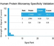 Beta-Catenin Antibody HuProt Microarray Specificity. Protein microarray analysis using Beta-Catenin Antibody (clone CTNNB1/2030R) demonstrates highly specific binding to CTNNB1 / Catenin beta-1, with the target protein ranked as the top hit and showing a strong Z score relative to all other proteins on the array. Signal intensity drops sharply for non-target proteins, supporting selective recognition with minimal off-target interaction. Z score represents the strength of signal in standard deviations above the mean of all array signals, while S score reflects the separation between the top-ranked target and the next highest signal, indicating relative specificity.