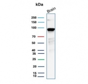 Beta-Catenin Antibody Brain WB. Western blot analysis of human brain tissue lysate using Beta-Catenin Antibody (clone CTNNB1/2030R) detects a clear band at approximately 90-95 kDa, consistent with the predicted molecular weight of Catenin beta-1 / CTNNB1 at ~85 kDa with a commonly observed upward shift during SDS-PAGE. This shift is consistent with known phosphorylation of beta-catenin, which can affect electrophoretic mobility. The band pattern aligns with expected expression of CTNNB1 in neural tissue.