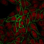 Beta-Catenin Transcriptional Marker HeLa IF. Immunofluorescence analysis of human HeLa cells using Beta-Catenin Antibody (clone rCTNNB1/2173) shows prominent membranous staining outlining cell-cell junctions with additional cytoplasmic signal, consistent with CTNNB1 / Catenin beta-1 localization. Subpopulations of cells display increased intracellular distribution relative to junctional staining, a pattern associated with beta-catenin redistribution during Wnt pathway activation and transcriptional signaling. Reddot nuclear stain (red) highlights nuclei, providing contrast to the beta-catenin signal.