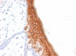 KRT10 Antibody rKRT10/844 by IHC in Human Skin. Immunohistochemistry of FFPE human skin tissue using KRT10 Antibody rKRT10/844. Strong brown cytoplasmic staining is observed in the suprabasal epidermal layers, with comparatively little staining in the basal keratinocytes and underlying dermis. The Recombinant Keratin 10 Antibody highlights differentiated epidermal cells, consistent with the expected distribution of KRT10 in stratified squamous epithelium. Nuclei are counterstained blue with hematoxylin. Heat-induced epitope retrieval was performed using 10 mM citrate buffer, pH 6, for 10-20 minutes, followed by cooling at room temperature for 20 minutes.