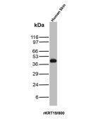 Recombinant CK19 Antibody rKRT19/800 in WB. Western Blot analysis of human skin tissue lysate using Cytokeratin 19 Antibody (clone rKRT19/800).