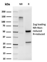SDS-PAGE analysis of purified, BSA-free recombinant KRT19 antibody (clone KRT19/1959R) as confirmation of integrity and purity.