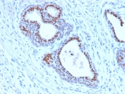 FOXA1 Antibody Human Tonsil IHC. Immunohistochemical staining of FFPE human tonsil tissue using FOXA1 Antibody / Developmental Transcription Factor Antibody (clone FOXA1/2230R) demonstrates strong nuclear HRP-DAB brown staining within epithelial cell populations lining glandular and crypt-associated structures. The staining pattern is consistent with expression of FOXA1, a forkhead family transcription factor that regulates developmental gene expression, epithelial differentiation, and tissue-specific transcriptional programs. The predominantly nuclear localization is characteristic of a DNA-binding transcriptional regulator and supports the role of FOXA1 in maintaining epithelial cellular identity and differentiated tissue phenotypes. HIER: boil sections in 10 mM Tris with 1 mM EDTA, pH 9 for 10-20 minutes followed by cooling at room temperature for 20 minutes.