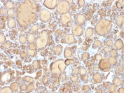 TG Antibody Recombinant Mouse MAb r6E1. Immunohistochemistry analysis of Thyroglobulin using TG Antibody Recombinant Mouse MAb r6E1 in FFPE human thyroid gland tissue section. HRP-DAB brown chromogenic staining highlights strong cytoplasmic signal in thyroid follicular epithelial cells forming thyroid follicles, with prominent staining of follicular luminal colloid material. The staining pattern is characteristic of Thyroglobulin expression in normal thyroid follicular epithelium and reflects its established role as a marker of thyroid follicular cell differentiation.