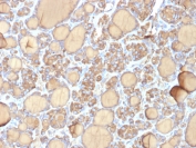 TG Antibody Recombinant Mouse MAb r6E1. Immunohistochemistry analysis of Thyroglobulin using TG Antibody Recombinant Mouse MAb r6E1 in FFPE human thyroid gland tissue section. HRP-DAB brown chromogenic staining highlights cytoplasmic signal in thyroid follicular epithelial cells forming well defined thyroid follicles, with strong staining of follicular luminal colloid material. The staining pattern is characteristic of Thyroglobulin expression in normal thyroid follicular epithelium and supports its role as a marker of thyroid follicular cell differentiation.