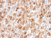 Thyroglobulin Antibody Recombinant Mouse MAb r2H11. Immunohistochemistry analysis of Thyroglobulin using Thyroglobulin Antibody Recombinant Mouse MAb r2H11 in FFPE human thyroid gland tissue section. HRP-DAB brown chromogenic staining highlights strong cytoplasmic signal in thyroid follicular epithelial cells forming thyroid follicles, with prominent staining of follicular luminal colloid material. The staining pattern is characteristic of Thyroglobulin expression in normal thyroid follicular epithelium and reflects its established role as a marker of thyroid follicular cell differentiation.