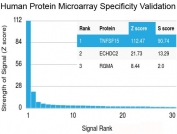 TL1A Antibody Protein Microarray Specificity Analysis. Analysis of HuProt(TM) microarray containing more than 19,000 full-length human proteins using recombinant rabbit monoclonal clone rVEGI/1283 identified TNFSF15 as the dominant target with a Z-score of 112.47 and an S-score of 90.74, supporting exceptionally strong target specificity for TL1A / TNFSF15 relative to unrelated proteins present on the array. The markedly elevated S-score demonstrates highly preferential binding to TNFSF15 with minimal off-target reactivity. The Z-score represents signal intensity generated by antibody binding relative to the mean signal across the array, while the S-score reflects the difference in signal strength between successive ranked targets and serves as a measure of relative target specificity.