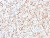 TL1A Antibody Spleen IHC. Immunohistochemistry staining of FFPE human spleen tissue using recombinant monoclonal clone rVEGI/1283 demonstrates membranous and cytoplasmic HRP-DAB brown staining predominantly within vascular endothelial structures and scattered stromal-associated cells, consistent with expression of TL1A / TNFSF15 in vascular and immune-regulatory tissue compartments. The observed staining pattern aligns with the established role of this TNF superfamily cytokine in inflammatory signaling, endothelial biology, and immune pathway regulation. Heat-induced epitope retrieval was performed by boiling sections in 10 mM Tris with 1 mM EDTA, pH 9, for 10-20 min followed by cooling at room temperature for 20 min prior to staining.
