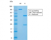 SDS-PAGE analysis of purified, BSA-free TG Antibody Recombinant Rabbit MAb TGB/1970R as confirmation of integrity and purity.