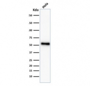 p53 Antibody Microarray Specificity Validated Clone TP53/2092R / TP53 Tumor Suppressor Antibody. Western blot analysis of human HeLa cell lysate demonstrates detection of Tumor protein p53 using the recombinant rabbit monoclonal clone TP53/2092R. Lane 1: human HeLa cell lysate. A band is detected at approximately 53 kDa, consistent with the predicted molecular weight of Tumor protein p53 / TP53. This result supports specific recognition of endogenous p53 protein by the Microarray Specificity Validated clone TP53/2092R in western blot analysis.