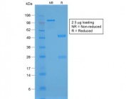SDS-PAGE analysis of purified, BSA-free recombinant NKX2.1 antibody (clone NX2.1/1855R) as confirmation of integrity and purity.
