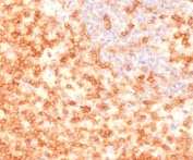 CD27 Antibody for IHC Tonsil Staining. Immunohistochemistry analysis of CD27 / TNFRSF7 expression in FFPE human tonsil tissue using CD27 Antibody / Memory B Cell Marker Antibody clone CDLA27-1R. Strong membranous HRP-DAB brown staining is observed in lymphocyte populations within germinal centers and surrounding mantle zones, consistent with CD27 expression on memory B cells and antigen-experienced lymphocytes, while adjacent stromal and epithelial elements remain largely negative. The staining pattern highlights memory B cell compartments and supports evaluation of humoral immune architecture within tonsillar tissue. Heat-induced epitope retrieval was performed in 10 mM Tris buffer with 1 mM EDTA, pH 9, for 10-20 minutes followed by cooling prior to antibody incubation.