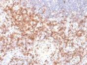 CD27 Antibody for Lymph Node IHC Staining. Immunohistochemistry analysis of CD27 / TNFRSF7 expression in FFPE human lymph node tissue using CD27 Antibody / Costimulatory Signaling Receptor Antibody clone LPFS2/2034R. Membranous HRP-DAB brown staining is observed in lymphocyte populations within follicular and paracortical regions, consistent with CD27 expression on activated and signaling-competent T and B cells, while surrounding stromal elements remain largely negative. The staining pattern highlights immune signaling compartments and supports evaluation of costimulatory receptor distribution within lymphoid tissue architecture. Heat-induced epitope retrieval was performed in 10 mM Tris buffer with 1 mM EDTA, pH 9, for 10-20 minutes followed by cooling prior to antibody incubation.