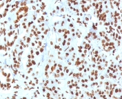 Histone H1 Antibody for IHC. Immunohistochemistry analysis of chromatin accessibility-associated histone H1 expression in FFPE human pancreas tissue using Histone H1 Antibody. Nuclear HRP-DAB brown staining is observed in pancreatic epithelial cells, consistent with localization of linker histone H1 within chromatin and its role in regulating DNA packaging and chromatin accessibility. Clone OSHT-3R antibody demonstrates strong nuclear compartmentalization with minimal cytoplasmic staining, reflecting chromatin-associated distribution across regions of regulated DNA accessibility.