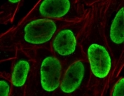 Histone H1 Antibody for IF. Immunofluorescence analysis of chromatin accessibility-associated histone H1 expression in PFA-fixed human HeLa cells using Histone H1 Antibody (green). Strong nuclear staining is observed, consistent with localization of linker histone H1 within chromatin and its role in regulating DNA packaging and chromatin accessibility. Clone OSHT-3R antibody demonstrates uniform nuclear enrichment with minimal cytoplasmic signal, reflecting chromatin-associated distribution across regions of regulated chromatin accessibility. Actin filaments are labeled with phalloidin (red), providing cytoskeletal contrast to the chromatin-associated histone signal.