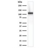 Cadherin 16 Antibody Human Kidney WB. Western blot analysis of Cadherin-16 / CDH16 expression in human kidney tissue lysate using Cadherin 16 antibody clone CDH16/2125. Lane 1: human kidney lysate. A band is detected at approximately 100â120 kDa, consistent with the predicted molecular weight of Cadherin-16 (CDH16), with the slightly higher apparent migration reflecting glycosylation of this kidney-restricted adhesion protein. The strong, distinct signal in kidney lysate supports the use of this antibody for kidney-specific expression analysis and aligns with the restricted distribution of CDH16 in renal epithelial tissue.