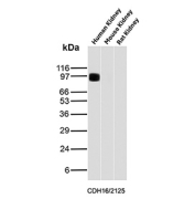 Cadherin 16 Antibody Kidney Tissue WB. Western blot analysis of Cadherin-16 / CDH16 expression in kidney tissue lysates using Cadherin 16 antibody clone CDH16/2125. Lane 1: human kidney lysate, Lane 2: mouse kidney lysate, Lane 3: rat kidney lysate. A band is detected at approximately 100â110 kDa in human kidney lysate, consistent with the predicted molecular weight of Cadherin-16 (CDH16), with minimal or no detectable signal in mouse and rat samples under these conditions. This pattern supports kidney-restricted expression with preferential detection in human tissue.
