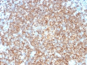CD22 Antibody Tonsil IHC. Immunohistochemistry analysis of CD22/Siglec-2 expression in FFPE human tonsil tissue using CD22 Microarray Specificity Validated Antibody clone BLCAM/1795. Strong HRP-DAB brown membranous and cytoplasmic staining is observed in B cell-rich regions, highlighting dense populations of lymphocytes consistent with CD22 expression in mature B cells, while surrounding non-lymphoid tissue remains largely negative. The staining pattern supports use of this CD22 antibody for immunohistochemistry-based identification of B cell populations with high specificity. Heat-induced epitope retrieval was performed using citrate buffer (pH 6) for 10-20 minutes followed by cooling at room temperature prior to antibody incubation.