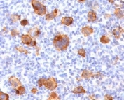 IHC testing of FFPE human Hodgkin