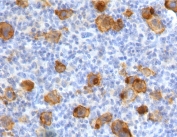 IHC testing of FFPE human Hodgkin