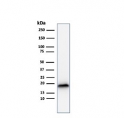 Melan-A Antibody WB. Western blot testing of human COLO-38 cell lysate with recombinant Melan-A antibody (clone rMLANA/788). Expected molecular weight ~20 kDa with possible doublet.