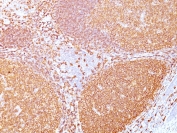IHC testing of FFPE human tonsil tissue with recombinant CD20 antibody (clone rIGEL/773). HIER: boil tissue sections in pH 9 10mM Tris with 1mM EDTA for 20 min and allow to cool before testing.