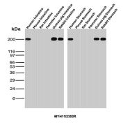 SMMHC Antibody Gastrointestinal Tissues WB. Western blot analysis of multiple gastrointestinal tissue lysates using SMMHC Antibody clone MYH11/2303R. Samples include human, mouse, rat, hamster, guinea pig, and rabbit intestine, as well as stomach tissues from the same species. MYH11, also known as Smooth Muscle Myosin Heavy Chain (SMMHC), is a contractile protein highly enriched in visceral smooth muscle cells and serves as a marker of smooth muscle differentiation. A prominent band is detected at approximately 200 kDa in human, guinea pig, and rabbit intestine, consistent with the expected molecular weight of MYH11. Species-dependent differences in signal intensity likely reflect variation in expression levels and epitope conservation. These results demonstrate the utility of MYH11 Antibody for studies of smooth muscle biology, gastrointestinal physiology, and cross-species tissue analysis.