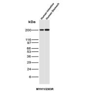 SMMHC Antibody Stomach and Intestine Tissues WB. Western blot analysis of human intestine and human stomach tissue lysates using SMMHC Antibody clone MYH11/2303R. SMMHC, also known as Smooth Muscle Myosin Heavy Chain or MYH11, is a major contractile protein that serves as a highly specific marker of differentiated smooth muscle cells. A strong band is detected at approximately 200 kDa in both tissue samples, corresponding to the expected molecular weight of full length MYH11. The robust expression observed in gastrointestinal tissues is consistent with the abundance of smooth muscle layers responsible for peristalsis and organ motility. These results support the utility of SMMHC Antibody for studies of smooth muscle differentiation, gastrointestinal physiology, and visceral smooth muscle pathology.