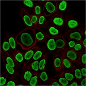 Histone H1 Antibody for IF. Immunofluorescence analysis of nuclear architecture-associated histone H1 expression in PFA-fixed human HeLa cells using Histone H1 Antibody (green). Strong nuclear staining is observed, consistent with localization of linker histone H1 within chromatin domains and its role in chromatin compartmentalization and nuclear organization. Clone r1415-1 antibody demonstrates uniform nuclear enrichment with minimal cytoplasmic signal, reflecting chromatin-associated distribution across organized nuclear domains. Actin filaments are labeled with phalloidin (red), providing cytoskeletal contrast to the chromatin-associated histone signal.