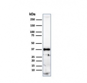 Histone H1 Antibody for WB. Western blot analysis of nuclear architecture-associated histone H1 expression in human heart tissue lysate. A band is detected at approximately 22-33 kDa, consistent with the predicted molecular weight range of Histone H1 family proteins, with lower bands corresponding to unmodified forms and higher bands reflecting post-translationally modified variants. The observed band pattern aligns with the role of histone H1 in chromatin domain organization and nuclear architecture.