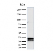 CD3e Antibody. Western blot analysis of CD3 Epsilon / CD3E antibody in human Jurkat cell lysate using CD3e Antibody / Microarray Specificity Validated Antibody (clone C3e/2479). A band is detected at approximately 20-25 kDa, consistent with the predicted molecular weight of CD3 epsilon. The clean band pattern with minimal background supports specific target recognition, aligning with the protein microarray validation profile of clone C3e/2479 and confirming reliable detection of CD3 epsilon in cell lysates.