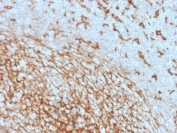 IHC analysis of CD14 antibody in human tonsil tissue. Formalin-fixed, paraffin-embedded human tonsil shows HRP-DAB brown membranous and cytoplasmic staining in macrophage-rich areas using CD14 antibody (clone LPSR/2408). Hematoxylin counterstain highlights nuclei in blue. Heat induced epitope retrieval was performed by boiling tissue sections in 10mM Tris with 1mM EDTA, pH 9, for 10-20 minutes followed by cooling at room temperature for 20 minutes.