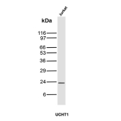 CD3e Antibody Clone UCHT1. Western blot analysis of CD3 Epsilon / CD3E antibody in human Jurkat cell lysate using CD3e Antibody Clone UCHT1 / CD3 Epsilon Monoclonal Antibody. Lane 1: human Jurkat cell lysate. A band is detected at approximately 23 kDa, consistent with the predicted molecular weight of CD3 epsilon. The single, well-defined band with minimal background supports specific target recognition and reliable detection of CD3 epsilon in T-cell lysates.