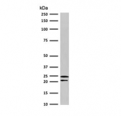 CD3 epsilon Antibody. Western blot analysis of CD3 Epsilon / CD3E antibody using CD3 epsilon Antibody / Adaptive Immune Response Marker Antibody with Clone CDLA3e-1 in human Jurkat cell lysate. Lane 1: human Jurkat cell lysate. A band is detected at approximately 23 kDa, consistent with the predicted molecular weight of CD3 epsilon. The strong, well-defined band supports reliable detection of CD3E in T-cell-derived lysates and aligns with its role in adaptive immune response signaling.