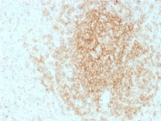 CD21 Antibody B-cell Zone IHC. Immunohistochemistry testing of FFPE human tonsil tissue with CD21 antibody (clone CR2/1953). HIER: boil tissue sections in pH6, 10mM citrate buffer, for 10-20 min followed by cooling at RT for 20 min.