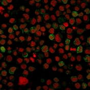 CD22 Antibody for IF. Immunofluorescence analysis of CD22/Siglec-2 expression in human Ramos B cell lymphoma cells using CD22 Immunofluorescence Antibody clone BLCAM/1796. CD22 staining (green) highlights prominent membrane-associated localization outlining B cell surfaces, consistent with its role as a B cell receptor regulatory protein, while Reddot nuclear stain (red) labels nuclei. The staining pattern supports identification of CD22-positive B cell populations and visualization of cell surface receptor distribution in lymphoma-derived cells.