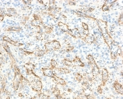 Immunohistochemistry of VEGI antibody in human spleen tissue. FFPE human spleen shows cytoplasmic and membranous HRP-DAB brown staining within vascular endothelial and scattered stromal cell populations, consistent with Vascular endothelial growth inhibitor / TNFSF15 localization in immune and vascular compartments. Clone TLRM1-2R was used as a recombinant rabbit monoclonal antibody for detection. Heat-induced epitope retrieval was performed by boiling sections in 10 mM Tris with 1 mM EDTA, pH 9, for 10-20 minutes followed by cooling at room temperature for 20 minutes prior to staining.