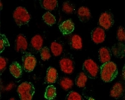 CD22 Antibody for IF. Immunofluorescence analysis of CD22/Siglec-2 in human Ramos B cell lymphoma cells using CD22 Intracellular Signaling Antibody clone CDLA22-1. Fluorescent signal (green) reveals both membrane-associated staining and distinct punctate cytoplasmic localization consistent with receptor internalization and intracellular trafficking, while Reddot nuclear stain (red) marks nuclei. The observed distribution highlights CD22 involvement in signaling dynamics and receptor cycling within B cell populations.