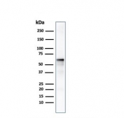 AKT1 Antibody MCF7 WB. Western blot testing of human MCF7 cell lysate with AKT1 antibody. Predicted molecular weight ~56 kDa.