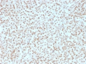 AKT1 Antibody Pancreas IHC. Immunohistochemistry testing of FFPE human pancreas with AKT1 antibody (clone AKT1/2491). HIER: boil tissue sections in pH 9 10mM Tris with 1mM EDTA for 10-20 min followed by cooling at RT for 20 min. 