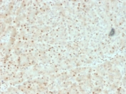 AKT1 Antibody Pancreas Signaling IHC. Immunohistochemistry of FFPE human pancreas tissue using AKT1 antibody highlights HRP-DAB brown cytoplasmic and nuclear staining in pancreatic epithelial cells, consistent with active PI3K-AKT signaling, while stromal regions show lower background; detection was performed with clone AKT1/2552. HIER: boil tissue sections in pH6 10mM citrate buffer for 10-20 min followed by cooling at RT for 20 min.