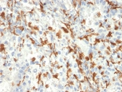 AIF1 Antibody Human Kidney IHC. Immunohistochemistry analysis of FFPE human kidney tissue using AIF1 Antibody (clone AIF1/2493) demonstrates HRP-DAB brown cytoplasmic staining in interstitial macrophages and mononuclear cells surrounding renal tubules and glomeruli, consistent with AIF1 / IBA1 expression as a macrophage activation marker involved in immune surveillance and inflammatory response, while tubular epithelial cells remain largely negative; nuclei are counterstained blue. HIER: boil tissue sections in pH 6 10 mM citrate buffer for 10-20 min followed by cooling at room temperature for 20 min.