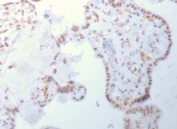 DNMT3A Antibody Placenta IHC. Immunohistochemistry analysis of FFPE human placental tissue using DNMT3A Antibody shows nuclear staining in trophoblast and stromal cell populations, consistent with localization of DNMT3A / DNA methyltransferase 3 alpha as a nuclear epigenetic regulator. Staining is observed within cell nuclei lining placental structures, reflecting active de novo DNA methylation processes during development. Hematoxylin counterstain provides nuclear contrast and tissue architecture. HIER: boil FFPE tissue sections in 1 mM EDTA, pH 9, for 10-20 min and allow to cool before testing.
