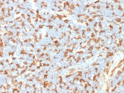 IBA1 Antibody Human Lymph Node IHC. Immunohistochemistry analysis of FFPE human lymph node tissue using IBA1 Antibody (clone AIF1/1909) shows strong HRP-DAB brown cytoplasmic staining in macrophages and dendritic-like cells within paracortical and sinusoidal regions, highlighting AIF1 / IBA1 expression in tissue-resident immune cells that share functional lineage with microglia, consistent with its role as a microglia marker and macrophage activation marker; nuclei are counterstained blue. HIER: boil tissue sections in pH 6 citrate buffer for 10-20 min and allow to cool before testing.
