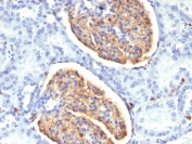 IBA1 Antibody Human Kidney IHC. Immunohistochemistry analysis of FFPE human kidney tissue using IBA1 Antibody (clone AIF1/1909) demonstrates HRP-DAB brown cytoplasmic staining in interstitial macrophages and mononuclear cells surrounding renal tubules and glomeruli, while tubular epithelial cells remain largely negative, highlighting AIF1 / IBA1 expression in tissue-resident macrophages that are functionally analogous to microglia, consistent with its role as a microglia marker and immune activation marker; nuclei are counterstained blue. HIER: boil tissue sections in pH 6 citrate buffer for 10-20 min and allow to cool before testing.
