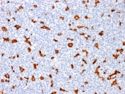 IBA1 Antibody Human Tonsil IHC. Immunohistochemistry analysis of FFPE human tonsil tissue using IBA1 Antibody (clone AIF1/1909) shows HRP-DAB brown cytoplasmic staining in scattered macrophages and dendritic-like cells within germinal centers and interfollicular regions, while lymphocytes remain largely negative, highlighting AIF1 / IBA1 expression in immune cell populations that share functional lineage with microglia, consistent with its role as a microglia marker and macrophage activation marker; nuclei are counterstained blue. HIER: boil tissue sections in pH 6 citrate buffer for 10-20 min and allow to cool before testing.