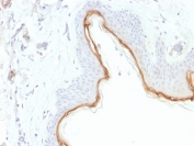 Filaggrin Antibody Epidermal Barrier IHC. Immunohistochemistry testing of FFPE human skin with Filaggrin antibody (clone FLG/1945). Required HIER: boil tissue sections in 10mM citrate buffer, pH 6, for 10-20 min.