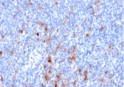 CD25 Antibody Human Tonsil IHC. Immunohistochemistry testing of FFPE human tonsil tissue with CD25 antibody (clone IL2RA/2395). HIER: boil tissue sections in pH9 EDTA for 10-20 min followed by cooling at RT for 20 min.