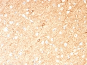 GAD67 Antibody Brain IHC. Immunohistochemistry analysis of FFPE human brain tissue stained with GAD67 Antibody demonstrates diffuse cytoplasmic HRP-DAB brown staining throughout neural parenchyma with enhanced labeling of scattered neuronal cell bodies, consistent with Glutamate decarboxylase 67 / GAD1 expression in GABAergic neuronal populations. This GABA synthesis enzyme antibody highlights inhibitory neurotransmitter-associated signaling pathways and neuronal differentiation within central nervous system tissue. Required HIER: boil tissue sections in 10mM citrate buffer, pH 6, for 10-20 min.